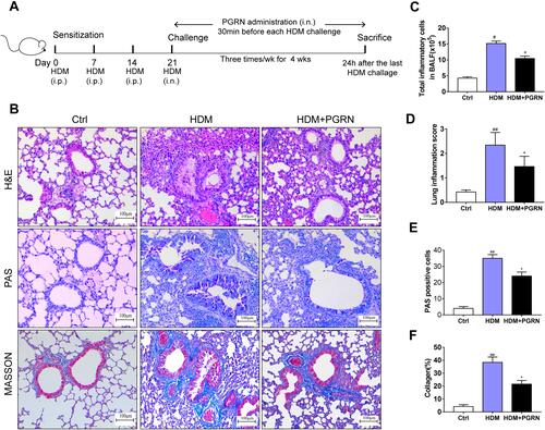 Figure 1 Effects of PGRN on airway remodeling in HDM-challenged asthmatic mice. (A) Schematic diagram of the experimental plan for HDM-induced murine asthma. (B) H&E, PAS and Masson’s trichrome staining of lung sections from different groups. (C) The counts of total inflammatory cells in BALF from mice analyzed by Wright staining. (D) Levels of inflamed lung areas in mice. (E) Quantification of PAS-positive mucous cells in airways of each group. (F) Analysis of collagen deposition in airway tissues. Quantitation of lung morphology analysis was based on 5 random areas from each sample. Data are expressed as means ± SEMs of three independent experiments with four mice per group. #p<0.05 vs control group, ##p<0.01 vs control group, *p<0.05 vs HDM group.