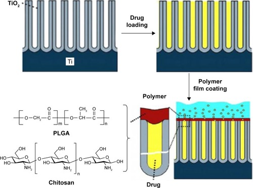 Figure 5 Schematic diagram of TNTs implants loaded with drugs where the nanotubes were covered with ultrathin film of biodegradable polymer (PLGA or chitosan) using a simple dip-coating process.Notes: Reprinted from Acta Biomater, Volume 8, Gulati K, Ramakrishnan S, Aw MS, Atkins GJ, Findlay DM, Losic D. Biocompatible polymer coating of titania nanotube arrays for improved drug elution and osteoblast adhesion, pages 449–456, Copyright 2012, with permission from Elsevier.Citation80Abbreviations: PLGA, poly (lactic-co-glycolic acid); TNT, TiO2 nanotube.