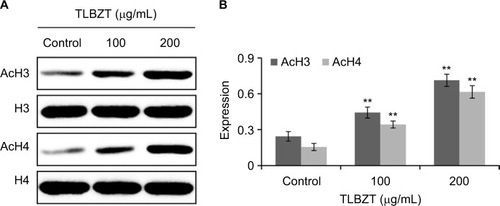 Figure 4 Effects of TLBZT on H3 and H4 acetylation.