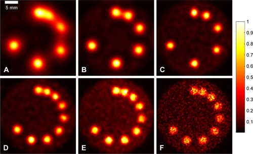 Figure 5 Reconstructed images of (upper) phantom (I) and (lower) phantom (II) with (A) 3.7 mm, (B) 2 mm, (C and D) 1 mm, (E) 0.5 mm and (F) 0.25 mm multi-pinhole. Note: Results are shown for the XFCT setup with 100 billion particles and a one-sided detector.Abbreviation: XFCT, X-ray fluorescence computed tomography.