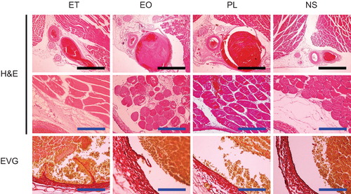 Figure 4. Representative histological findings of the femoral vein and surrounding tissue 24 hours after injection of sclerotic agents. The black and blue scale bars represent 100 µm and 10 µm, respectively. H&E = haematoxylin and eosin; EVG = Elastica van Gieson.