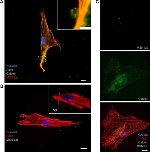 Figure 5 MSN-Lip are endocytosed and can deliver cargo to the cytosol.Notes: (A) calcein (green) loaded MSNs (red) were endocytosed as visualized using fluorescent microscopy and nuclei (DAPI, blue) and actin (phalloidin, orange) staining. (B) Maximum intensity projection from confocal microscope images, (inset shows 3D perspective) showing Cell internalization of MSNs (green) in hMSCs. (C) Simultaneous cell labeling and cargo delivery to the cytosol of hMSCs was possible using calcein-loaded MSN-Lip: hMSCs (actin, red), MSN-Lip (light blue), and calcein dye (green) nucleus (DAPI, blue). Bar 20 µm.Abbreviations: hMSC, human mesenchymal stem cell; Lip, lipid; MSNs, mesoporous silica nanoparticles.