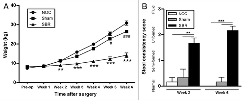 Figure 1. Clinical effects of small bowel resection. (A) The weight of piglets that received a small bowel resection (SBR) was significantly lower two weeks post-surgery than those that received a sham surgery (Sham) or no surgery (NOC; **p < 0.01). This suboptimal weight gain was sustained for the duration of the experiment (***p < 0.001 at week 3, p < 0.0001 at weeks 4, 5 and 6). The sham piglets also had a significantly lower weight gain at weeks 5 (#p < 0.05) and 6 (###p < 0.0001) compared with the NOC group. Values are expressed as mean ± SEM; n = 12 NOC, n = 10 sham, n = 12 SBR at pre-op, week 1 and week 2; n = 6 NOC, n = 5 sham, n = 6 SBR at weeks 3, 4, 5 and 6. (B) Piglets in the SBR group had a significantly higher stool consistency score than the sham and NOC groups two weeks (**p < 0.01) and six weeks (***p < 0.001) post-surgery. Values are expressed as mean ± SEM; n = 5−6/group/time-point.