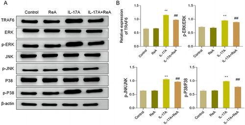 Figure 6 ReA inhibits TRAF6/MAPK signaling pathway activated by IL-17A stimulation in HaCaT cells. (A) Western blot images of TRAF6/MAPK signaling pathway-related proteins. (B) Statistical results of TRAF6/MAPK signaling pathway-related protein levels in cells of Control group, ReA group, IL-17A group, and IL-17A+ReA group. **P < 0.01, vs Control group; ##P < 0.01, vs IL-17A group. Three experiments were repeated.