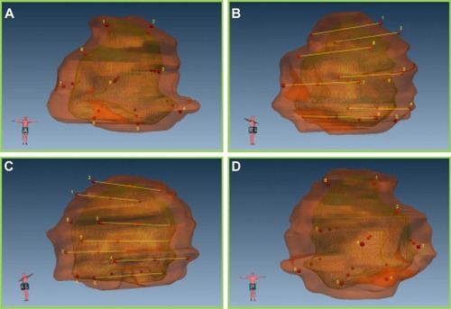 Figure 2 The distribution of implanted particles from all angles, which involve nine implantation sites.