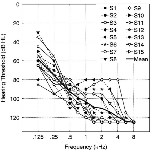 Figure 2. Mean and individual hearing thresholds in the non-implanted ear as assessed with standard pure tone audiometry. Subjects with black markers started with the broadband fitting and subjects with white markers started with the three-band fitting. Thresholds beyond the audiometer limit (120 dB HL) were assigned a value of 125 dB HL.