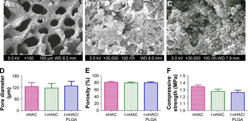 Figure 2 SEM images of the structure of the nHAC scaffold (A, B) and nHAC/PLGA composite scaffolds (C). Pore diameters (D), porosity (E), and compressive strengths (F) of the composite scaffolds.Abbreviations: nHAC, nano-hydroxyapatite/collagen; PLGA, poly lactic-co-glycolic-acid; SEM, scanning electron microscope.