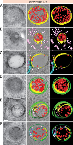 Figure 2. Electron tomography reveals ultrastructure of different stages of simaphagy. (a) Electron tomography projections (left) and 3D reconstructions of a representative endosome from HeLa cells with stable expression of eGFP-HGS[Citation1-770]. Endogenous HGS has been knocked down using siRNA. Cells have been stimulated with EGF for 60 min prior to high pressure freezing and sample preparation for electron microscopy. PAG10-gold labelled EGFR [Citation66] accumulates under the endosome limiting membrane (yellow). A subset of PAG10 [Citation67] can be found further away from the endosome limiting membrane, most likely due to receptor-internalization as they often appear adjacent to ILVs (red). (b) Representative TEM projection and reconstruction of cytosolic vesicles (light pink) in proximity to a HGS[Citation1-770] endosome. Often, the areas containing vesicle clusters coincide with on-section immuno-labelling of SQSTM1 (white). (c) Double-membrane sheet (green) wedged between ER (cyan; ribosomes in pink) and endosome limiting membrane (yellow). Cytosolic vesicles in close vicinity are depicted in light pink. (d) PAG10-containing endosome engulfed by a double membrane (green) in a manner resembling selective and exclusive autophagy. (e) Double membrane (green) surrounding a PAG10-containing endosome and portions of the cytosol resembling selective and non-exclusive autophagy. (f) Single membrane (green) surrounding a PAG10-containing endosome and portions of the cytosol/other organelles resembling an autolysosome in which the inner autophagic membrane has been degraded. Scale bar: 200 nm for all images.