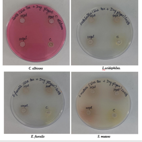 Figure 8. Antibacterial activity of Se NPs against caries-causing microbes (C. albicans, L. acidophilus, E. faecalis and S. mutans) at different concentrations and zone of inhibition was measured in millimetres.