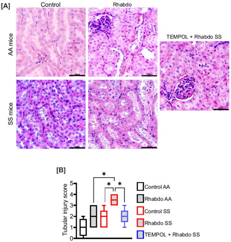 Figure 6. Rhabdo-induced oxidative stress causes significant renal tubular damage in SS mice. (A) Representative H&E-stained kidney sections and (B) box & whiskers plot of tubular injury score in control AA (n = 4) and SS (n = 5), rhabdo AA (n = 5) and SS (n = 6), and TEMPOL + rhabdo SS (n = 5) groups. (one-way ANOVA, with Holm-Šídák’s posthoc test); scale bar = 50 µm.