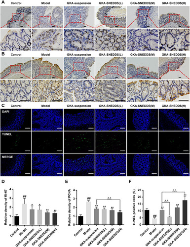 Figure 6 Administration of GKA inhibits cell proliferation and induces apoptosis in the colon. (A) Cell proliferation was measured via Ki-67 staining of colon sections from mice (upper, 10 × objectives; lower, 40 × objectives; Scale bar, 100μm.). (B) Cell proliferation was measured via PCNA staining of colon sections from mice (upper, 10 × objectives; lower, 40× objective; Scales bar, 100μm.). (C) Representative images of fluorescent DAPI and TUNEL staining of colon sections from mice (upper, 10 × objective; lower, 40 × objectives; Scale bar, 100μm.). (D) The relative density of Ki-67 in colon tissue. (E) The relative density of PCNA in colon tissue. (F) The percentages of apoptotic cells in the colon tissue were quantified and normalized versus the number of nuclei. Data are presented as mean ± SD (n=8). ##p < 0.01 compared with the control group, *p < 0.05 and **p < 0.01 compared with the model group, ΔΔp < 0.01 compared with the GKA-suspension-treated group.