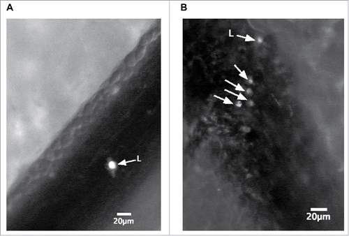 Figure 3. Intravital micrographs of female NOD mouse pancreatic microvasculature (20 fold magnification), depicting low (A) and elevated (B) degrees of leukocyte adhesion (L and arrows). Fifteen minutes prior to IVM, NOD mice received Rodamine-6G (via tail vein injection) which allowed observation of leukocyte rolling and adhesion via IVM.