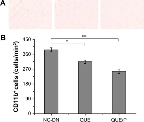 Figure 7 QUE/P decreases inflammatory cell infiltration to the DN.Notes: (A) Image of immunohistochemical staining for CD11b+ myeloid cells in NC-DN group, QUE group, QUE/P group, respectively; (B) quantitative value in NC-DN group, QUE group, QUE/P group, respectively. A remarkable decrease relative to the NC-DN group is denoted by “*” (p<0.01) and a remarkable decrease relative to NC-DN group is denoted by “**” (p<0.01).Abbreviations: QUE/P, quercetin/poly(ethylene glycol)-b-(poly(ethylenediamine l-glutamate)-g-poly(ε-benzyloxycarbonyl-l-lysine)); DN, diabetic nephropathy; NC, normal control.