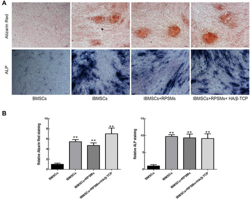 Figure 4 The effects of drugs on osteogenic differentiation of BMSCs were conducted by the Alizarin Red and ALP staining after 21 days of culture.