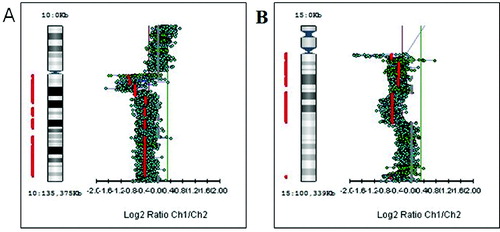 Figure 3. Genetic losses of chromosome arms. (A) Deletion of the long arm of chromosome 10 (10q−). (B) Deletion of the long arm of chromosome 15 (15q−).