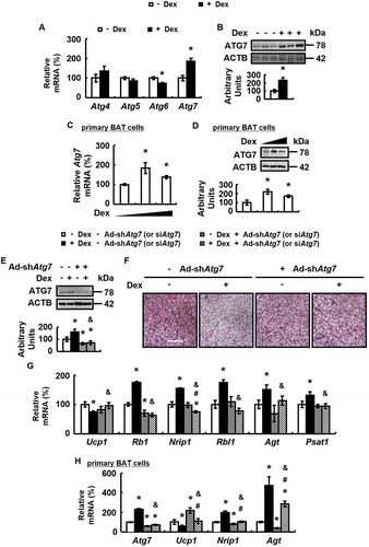 Figure 3. Dex stimulates ATG7 expression and knockdown of ATG7 prevents Dex-induced BAT whitening in vivo and vitro. (A and B) mRNA levels of Atg4, Atg5, Atg6 and Atg7 (A) and ATG7 protein levels (B) were analyzed in BAT of male WT mice i.p. injected with Dex (+ Dex) or PBS (- Dex) for 1 week. (C and D) Atg7 mRNA (C) and protein (D) levels were analyzed in primary cultured brown adipocytes treated with 0, 1 or 5 μM Dex for 24 h. (E-G) ATG7 protein levels (E), H&E staining (F), mRNA levels of brown adipocyte markers and white adipocyte markers (G) were analyzed in BAT of male WT mice infected with Ad-shAtg7 (+ Ad-shAtg7) or Ad-Scrambled (- Ad-shAtg7) for 3 days, followed by i.p. injection of Dex (+ Dex) or PBS (- Dex) for 1 week. (H) mRNA levels of brown adipocyte markers and white adipocyte markers were analyzed in primary cultured brown adipocytes transfected with (+ siAtg7) or without (- siAtg7) Atg7 siRNA for 48 h, prior to being treated with Dex (+ Dex) or PBS (- Dex) for 24 h. Scale bars: 200 μm in F. Data are represented as mean ± SEM. Statistical significance was calculated using the two-tailed Student t-test for the effects of with compared to without Dex (*: p < 0.05) in A-D, or one-way ANOVA followed by the Student-Newman-Keuls (SNK) test for the effects of any group versus the control group (*: p < 0.05), with versus without Dex in ATG7 knockdown group (#: p < 0.05), with versus without ATG7 knockdown in Dex group (&: p < 0.05) in E, G and H.