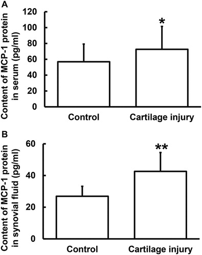 Figure 3. Relative expression of MCP-1 protein in serum (A) and synovial fluid (B) from patients with cartilage injury of elbow joint of upper limbs. Note: ELISA was used to determine the content of protein (pg/mL). *p < 0.05 and **p < 0.01 compared with control group.