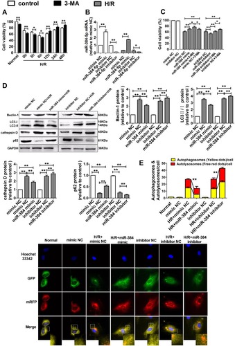 Figure 3 miR-384 attenuated H/R-stimulated H9c2 cells autophagy in vitro.