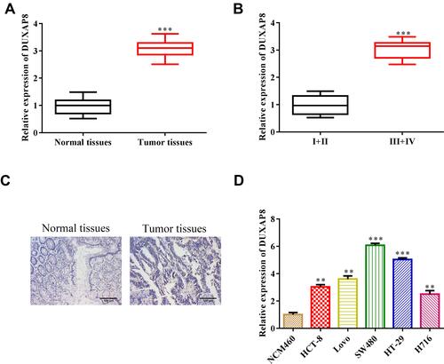 Figure 1 DUXAP8 is increased in colorectal cancer. (A) RT-qPCR analysis of the expression level of Duxap8 in colorectal cancer tissues and adjacent non-cancer tissues. ***P < 0.001 vs normal tissues group. (B) RT-qPCR analysis of the expression level of Duxap8 in different stages of colorectal cancer. ***P < 0.001 vs I + II group. (C) Subcellular fractionation analysis of the location of Duxap8. (D) RT-qPCR analysis of the expression level of Duxap8 in colorectal cancer cell lines. **P < 0.01, ***P < 0.001 vs NCM460 group. All results were presented as the mean ± SD from at least three separate experiments.