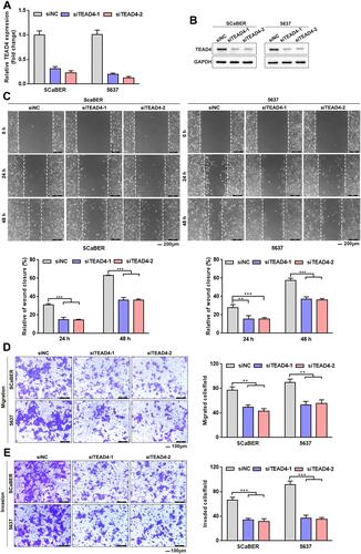 Figure 5 TEAD4 knockdown inhibits UBC cells migration and invasion. (A and B) TEAD4 knockdown in SCaBER and 5637 cell lines were confirmed by qRT-PCR (A) and Western blotting (B) after transfection with siRNAs (siNC, siTEAD4–1, siTEAD4–2). (C–E) Effects of TEAD4 knockdown on migration and invasion abilities of UBC cells were examined by wound healing (C) and transwell (D and E) assays. Scale bar, 200μm (C) and 100μm (D and E). Right, statistical analysis. **P<0.01, ***P<0.001.