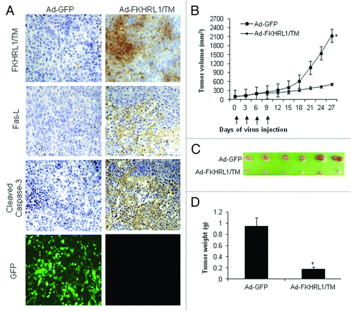Figure 6. Immunohistochemistry and antitumor effect of treatment with adenovirus expressing FKHRL1/TM. After subcutaneous administration of 5 × 106 A2058 cells, mice with palpable tumors were randomized to receive a local injection of Ad-GFP or Ad-FKHRL1/TM on days 0, 3, 6, and 9 (vertical arrows) at a concentration of 1 × 109 pfu (plaque forming units). (A) Immunohistochemistry of A2058 melanoma tumors at 24 h after last treatment with Ad-GFP or Ad-FKHRL1/TM. GFP expression was visualized by fluorescence microscopy. FKHRL1/TM, Fas-L, and cleaved caspase-3 expressions were detected by immunohistochemistry. (B) Tumor volume was plotted over time. Volume (V) was determined by V = (L × W 2)/2 of tumor measured using calipers. (C) On day 27, tumors were excised and photographed. The relative size of tumors is shown. (D) Tumors were also weighed on day 27. The results are expressed as the mean ± SEM for each treatment group. The differences in tumor size and weight in animals treated with Ad-FKHRL1/TM were statistically significant on day 27 compared with Ad-GFP control (*p < 0.05).