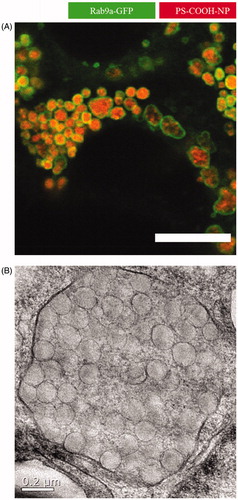Figure 2. Close-up of nanoparticles trapped in late endosomes/lysosomes. In this study, Caco-2 cells were incubated with 500 µg/mL polystyrene nanoparticles for 24 hours. The addition resulted in huge endolysosomal structures up to 2 µm in diameter as analyzed by (A) confocal laser scanning microscopy (scale bar =10 µm) and (B) transmission electron microscopy (Reinholz et al., Citation2018). Reprinted from J. Reinholz, C. Diesler, S. Schöttler, M. Kokkinopoulou, S. Ritz, K. Landfester, V. Mailänder, Protein Machineries defining Pathways of Nanocarrier Exocytosis and Transcytosis, Acta Biomaterialia, Copyright (2018) with permission from Elsevier.