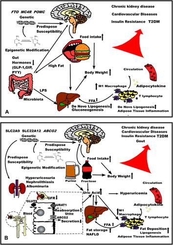 Figure 1 The comparison of pathophysiology of (A) obesity and (B) hyperuricemia.Abbreviations: GFR, glomerular filtration rate, NAFLD, non-alcoholic fatty liver disease.