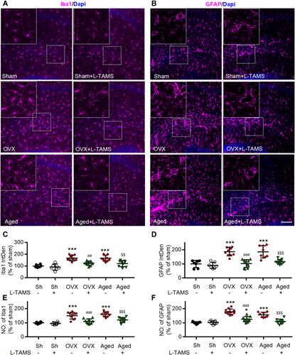 Figure 10 Oral application of L-TAMS attenuates the activation of microglia and astrocytes in hippocampi induced by ovariectomy and aged. (A and B) Representative confocal images of the immunofluorescence staining of Iba1 (A) and GFAP (B) in the different groups as indicated, Scale bar: 100 μm. (C and D) Statistical analysis of immunofluorescence intensity of Iba1 (C) and GFAP (D) in hippocampal of different groups (n = 3–4 mice/group, 2–3 sections/mouse). (E and F) The count of Iba1+ cell (E) and GFAP+ cell (F) in each 20× field were statistically analyzed (n = 3–4 mice/group, 2–3 sections/mouse). The data were analyzed by one-way ANOVA with Tukey’s test. *P<0.05, ***P<0.001, vs Sham (Sh); ##P<0.01, ###P<0.001, vs OVX; $$P<0.01, $$$P<0.001, vs Aged.