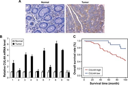 Figure 1 CUL4A is overexpressed and associated with prognosis in colorectal cancer.