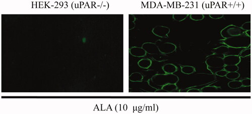 Figure 3. ALA selective binding to MDA-MB231 cells. HEK-293 or MDA-MB231 cells were treated with 10 ug/ml ALA for 4 h and then fixed in 4% paraformaldehyde. The ALA was detected by using an anti-Myc antibody and fluorescein-labeled secondary antibody. Green fluorescence shows ALA fusion protein exhibited specific affinity to MDA-MB-231 cells and mainly located on the surface.