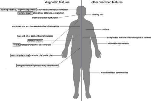 Figure 2 Major clinical features of BBS patients. On the left side diagnostic clinical features are listed (primary features outlined with rectangles). On the right side, less described clinical traits.