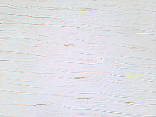 Figure 4. TUNEL-positive cells in untreated contralateral control: wavy collagen bundles interspersed with normal spindle-shaped fibroblasts (original magnification: × 750).