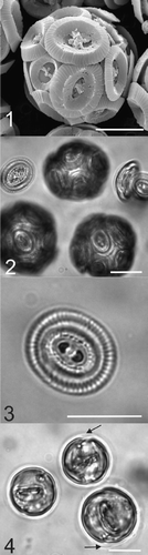 Figs. 1–4. Micrographs of Coccolithus pelagicus. Fig. 1. SEM image of a whole C. pelagicus cell (182g strain) showing coccolith morphology consistent with the temperate sub-species braarudii. Fig. 2. Light micrograph of C. pelagicus showing complete coccospheres and loose coccoliths, which were also present in the cell suspension. Fig. 3. Light micrograph showing detail of the distal shield and central bar of the coccoliths produced by C. pelagicus 182g. Fig. 4. EGTA-decalcified cells showing internal coccoliths at various stages of development and in two cells there is evidence of the loose periplasmic organic layer of scales (black arrows, see also Fig. 21). Scale bars: 10 µm.