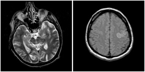 Figure 1. The brain MRI images.