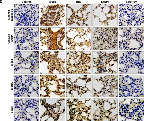 Figure 6 In vivo antiviral efficiency of Se@RBV.Notes: Mice infected by H1N1 virus was treated with physiological saline (Mock), RBV, SeNPs, or Se@RBV (A). Mice without infection and treated with physiological saline were performed as control. H&E and tunel staining (B), as well as immunohistochemistry (C), was carried out.Abbreviations: H&E, hematoxylin and eosin; MDCK, Madin-Darby Canine Kidney; PARP, poly-ADP-ribose polymerase; p-JNK, Jun-amino-terminal kinase; p38, phosphorylated 38; p53, phosphorylated 53; RBV, ribavirin; SeNPs, selenium nanoparticles; Se@RBV, SeNPs loaded with RBV.