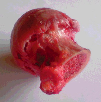 Figure 2. Human femoral hip head.