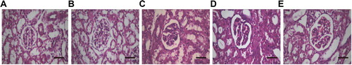 Figure 1. Histochemical staining of renal tissues. H&E staining was performed to detect the morphology of the renal tissues in the Control (A), Sham (B), Sepsis (C), PAG (D), and NaHS (E) groups, respectively (magnification ×200). Bar = 50 μm.