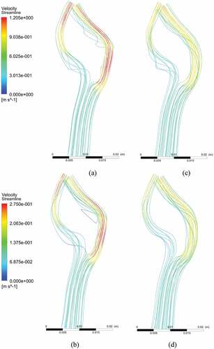 Figure 9. Velocity streamlines: (a) near peak systole in stenosed model; (b) at peak diastole in the stenosed model, (c) near peak systole in the stented model, (d) at peak diastole in the stented model.