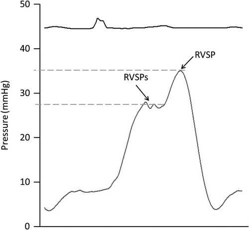 Figure 1. Measurement on right ventricular (RV) pressure waveform. RV systolic pressure (RVSP); RV pressure at ‘shoulder’ (RVSPs).