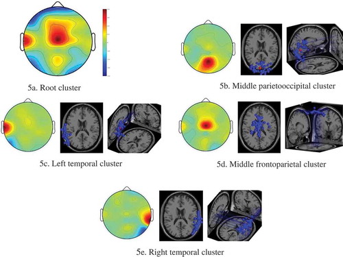 Figure 5. Scalp maps and 3D dipole plots for the soul music stimulation results.(a) Root cluster, (b) Middle parietooccipital cluster, (c) Left temporal cluster, (d) Middle frontoparietal cluster, (e) Right prefrontal cluster