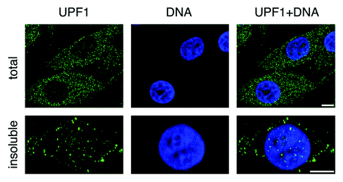 Figure 1. Confocal images of endogenous UPF1 distribution in human HeLa cancer cells. Indirect immunofluorescence staining was performed using goat polyclonal antibodies raised against a C-terminal peptide of UPF1 on fixed cells either untreated, to detect total UPF1 (upper panels), or pre-treated with mild detergents, to detect insoluble UPF1 (lower panels). UPF1 antibodies were revealed using secondary antibodies conjugated with Alexa 488 fluorochrome (shown in green), whereas DNA was stained using DAPI (in blue). Note the focal staining of insoluble UPF1 in the nucleus. Scale bars correspond to 10 μm.