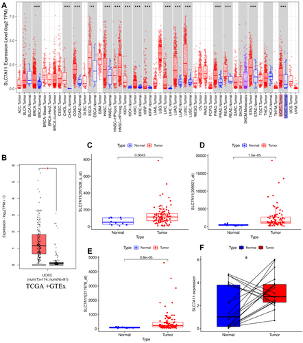Figure 2 Expression analysis of Solute carrier family 7 member 11 (SLC7A11). (A) SLC7A11 expression level in tumor and normal tissues in The Cancer Genome Atlas (TCGA) pan-cancer data using TIMER. (B) Analysis using the GEPIA2 database showed that SLC7A11 had higher expression in Uterine corpus endometrial carcinoma (UCEC) compared to normal tissues. (C-E) the boxplots were used to compare the expression levels of SLC7A11 gene in the different probe, including (C) 207528-s-at, (D) 209921-at, and (E) 217678-at, of Gene Expression Omnibus (GEO) datasets. (F) Paired differential analysis of SLC7A11 in UCEC in the TCGA database. (*p < 0.05, **p < 0.01, ***p < 0.001).