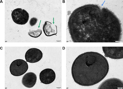 Figure 2 Transmission electron microscopy images of ATCC 25923. (A and B) ATCC 25923 treated with 5×MIC surfactin for 1 h. Green arrows indicate dead cells, and blue arrow indicates damaged cell structure. (C and D) Control, cells treated with 0.05% DMSO. Scale bars, 200 nm (left), 100 nm (right).