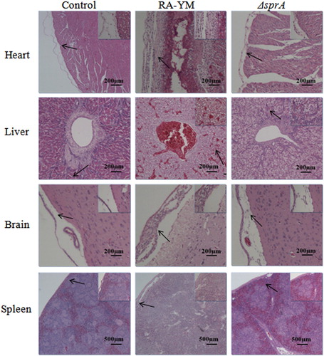 Figure 6. Photomicrograph of histopathological study on tissues from ducklings infected with wild-type strain RA-YM or mutant strain ΔsprA at 48 h post-challenge (HE × 400). The arrows in the figure indicate the normal (control group) and lesion (RA-YM or ΔsprA infected group) regions of the organs at 48 h post-challenge. Compared with the control group (the left column), there were obvious histopathological changes in the wild-type RA-YM infected group (the middle column): in heart, epicardium became thickened due to fibrin exudation and interstitial inflammatory cell infiltration; the spaces between myocardial fibres were significantly widened due to oedema; in liver, moderate to marked congestion was found in central vein and hepatic sinus, and fatty degeneration of the hepatic cells was more severe; in brain, fibrin exudation and inflammatory cell infiltration also occurred in cerebral arachnoid cavity; in spleen, white pulp lymphocyte hyperplasia occurred, and boundaries between white and red pulp became blurred, while germinal centres disappeared. The histopathological change in the mutant strain ΔsprA infected group (the right column) was slight, thus the tissues from this group looked similar to those of the control group.