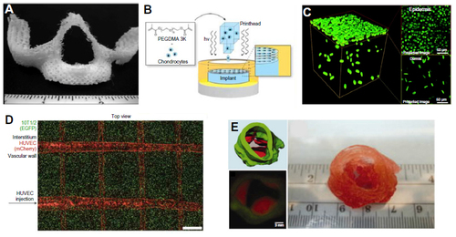 Figure 2 Examples of the bioprinted tissues.