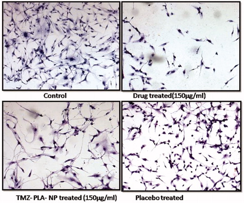 Figure 11. Cellular morphology assay for TMZ and TMZ developed nanoparticles on U-87 MG cell line. Developed nanoparticles exhibited stress on spindle fibers and rounding up of cells similar to the pure drug.