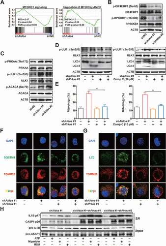 Figure 4. ALDOA controlled the initiation of mitophagy and NLRP3 inflammasome activation by restricting AMPK activation. (A) GSEA analyses of MTORC1 signaling gene sets (top) and AMPK-regulated MTOR gene sets (bottom) in J774A.1 cells stably expressing Aldoa shRNA vs nonspecific control shRNA. (B) Immunoblot analysis of p-EIF4EBP1 (Ser65), EIF4EBP1, p-RPS6KB1/S6K1 (Thr389) and RPS6KB1/S6K1 in J774A.1 cells stably expressing shRNA against Aldoa. (C) Immunoblot analysis of p-PRKAA/AMPKα (Thr172), PRKAA/AMPKα, p-ULK1 (Ser555), ULK1, p-ACACA/ACC (Ser79) and ACACA/ACC in J774A.1 cells stably expressing shRNA against Aldoa. (D) Immunoblot analysis of p-ULK1 (Ser555), ULK1 and LC3 in J774A.1 cells stably expressing shRNA against Aldoa and Prkaa (left) or shRNA against Aldoa treated with compound C (right). (E) FACS analysis LPS-primed J774A.1 cells stably expressing mito-Keima and shRNA against Aldoa and Prkaa (left) or shRNA against Aldoa treated with compound C (right), stimulated with nigericin (4 μM) for 3 h. (F and G) Intracellular distribution of SQSTM1 (F) or LC3 (G) and mitochondria (TOMM20) in LPS-primed J774A.1 cells stably expressing shRNA against Aldoa and Prkaa, stimulated with nigericin (4 μM) for 3 h, examined by confocal microscopy. Scale bars: 10 µm. (H) Immunoblot analysis of IL1B and CASP1 in supernatants (SN) and extracts (Input) of LPS-primed J774A.1 cells stably expressing shRNA against Aldoa and Prkaa, stimulated with ATP (5 mM) for 1 h, nigericin (4 μM) for 3 h, MSU (150 μg/ml) for 6 h. Data are presented as mean ± SD (n = 3). **P < 0.01.