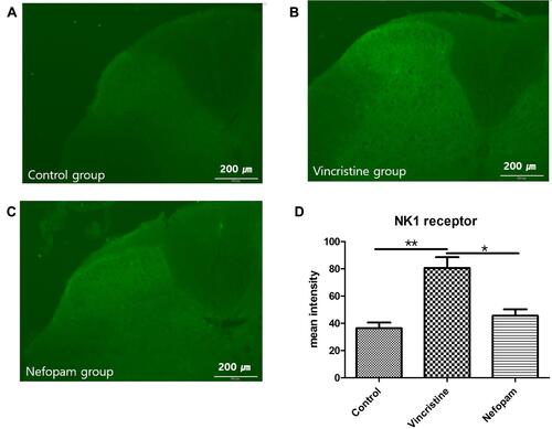 Figure 3 Effects of intraperitoneal nefopam on NK1 receptors after vincristine-induced neuropathy. Immunohistochemistry showed that NK1 receptor binding components were elevated in vincristine-induced neuropathic mice. (A) Representative spinal cord stained for NK1 receptor in a control mouse. (B) Representative spinal cord stained for NK1 receptor in a vincristine-induced neuropathic mouse. (C) Representative spinal cord stained for NK1 receptor in a vincristine-induced neuropathic mouse after 60 mg/kg nefopam treatment. (D) The percentage of NK1 receptors in the spinal cord was significantly lower in 60 mg/kg nefopam-injected mice (Nefopam) compared to saline-injected mice (Vincristine) in vincristine-induced neuropathic mouse models. *P<0.05, **P<0.01.