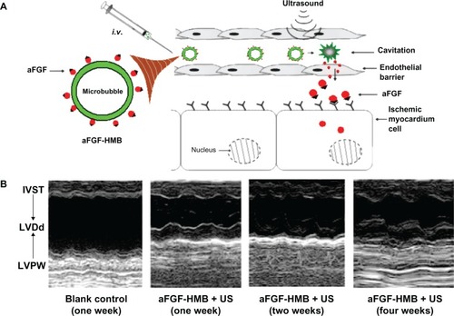 Figure 4 Improving intravenous delivery of acidic fibroblast growth factor to the ischemic myocardium by heparin-modified microbubbles (aFGF-HMB) combined with the UTMD technique. (A) Illustration of the method of administration. (B) M-mode echocardiography for the group that received aFGF-HMB combined with US (ultrasound).Citation29Note: Copyright © 2012. Informa Healthcare. Reproduced with permission from Zhao Y, Lu C, Li X, et al. Improving the cardio protective effect of aFGF in ischemic myocardium with ultrasound-mediated cavitation of heparin modified microbubbles: preliminary experiment. J Drug Target. 2012;20:623–631.Citation29Abbreviations: IVST, intraventricular septum thickness; LVDd, left ventricular diastolic dimension; LVPW, left ventricular posterior wall; UTMD, ultrasound-targeted microbubble destruction.