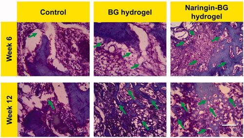 Figure 9. H&E-stained damaged tissue sections from 6 and 12 weeks surgery after treatment with control, BG hydrogel, and Naringin–BG hydrogel groups. Scale bar 100 µm.